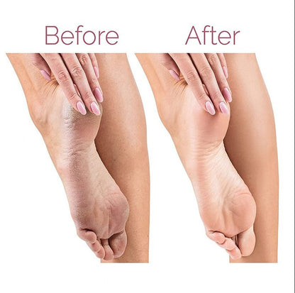 Electric Pedicure Foot File Callus Remover