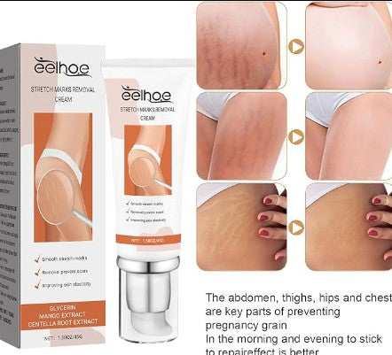 Eelhoe - Stretch Marks Removal Cream